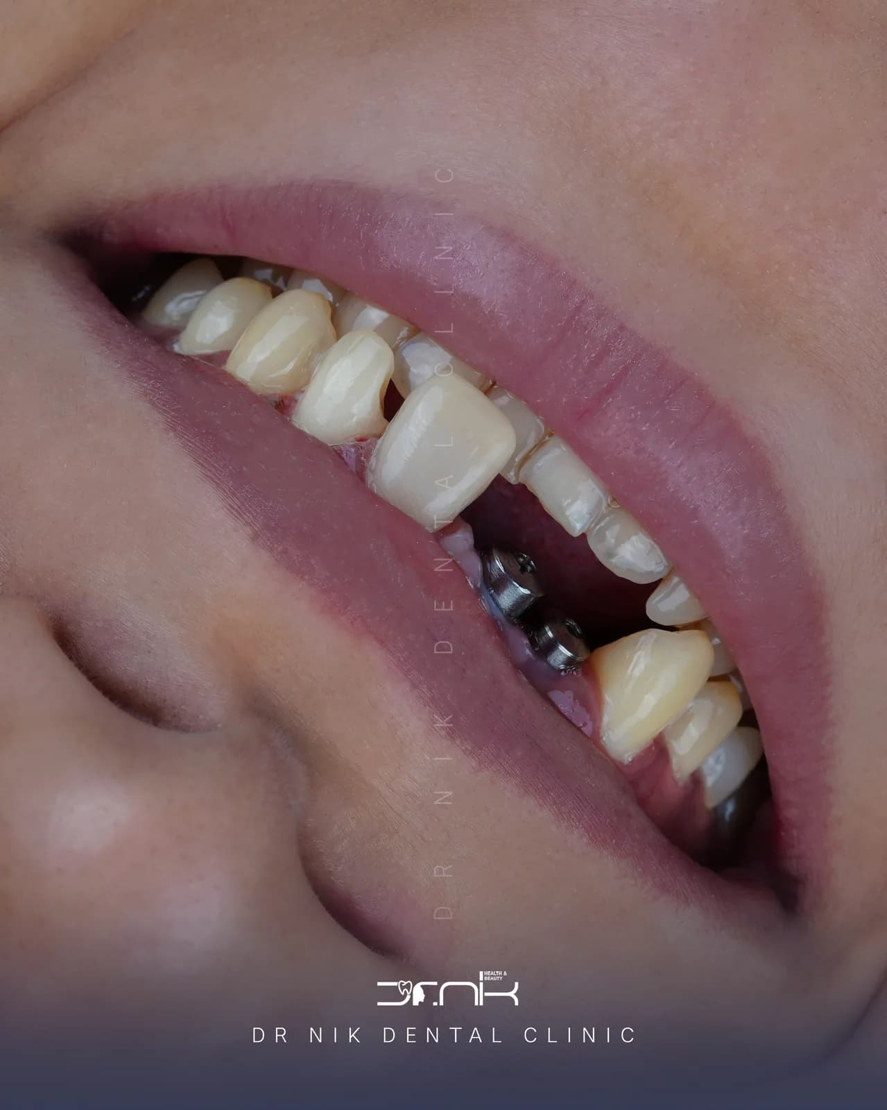 بیمار 4