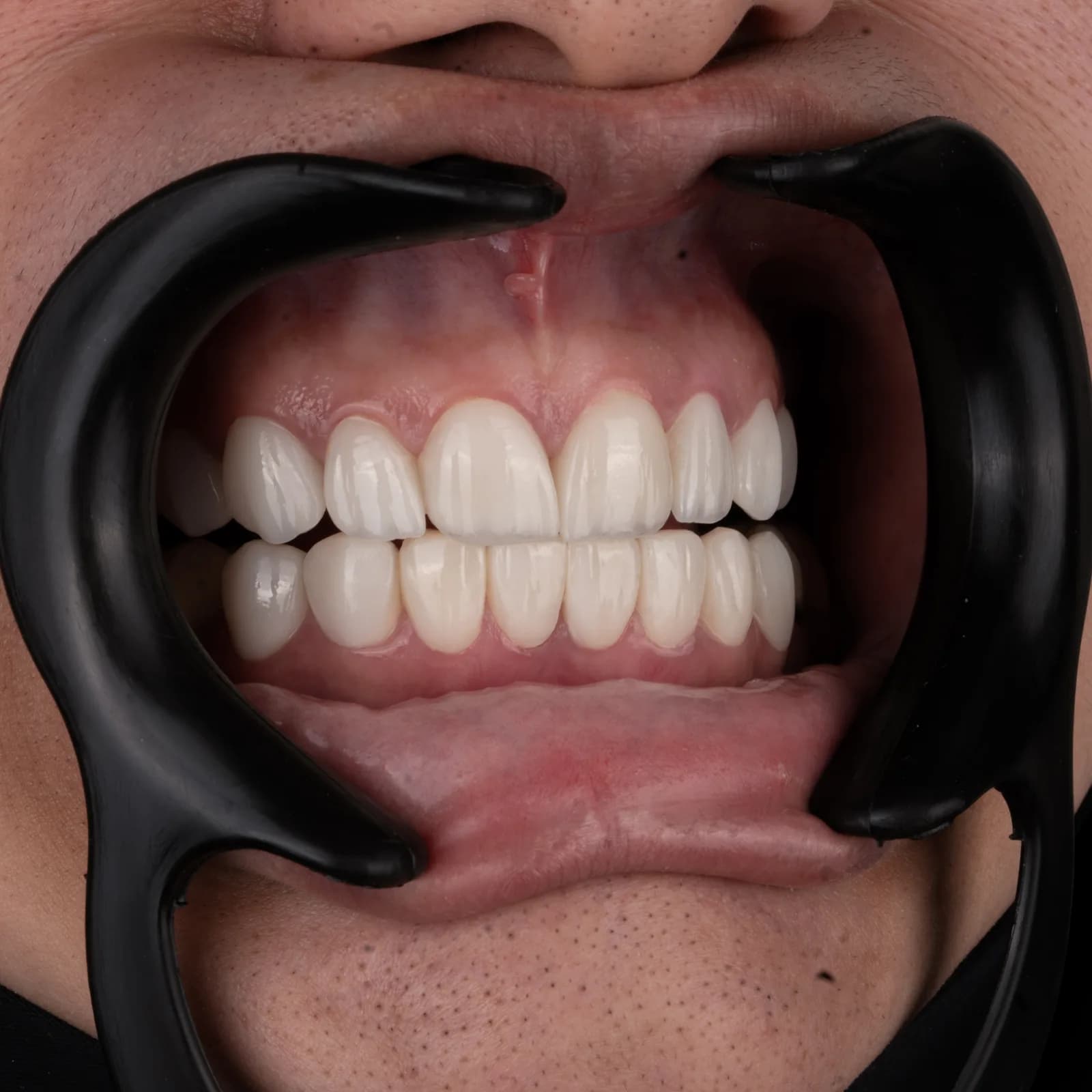 بیمار 7