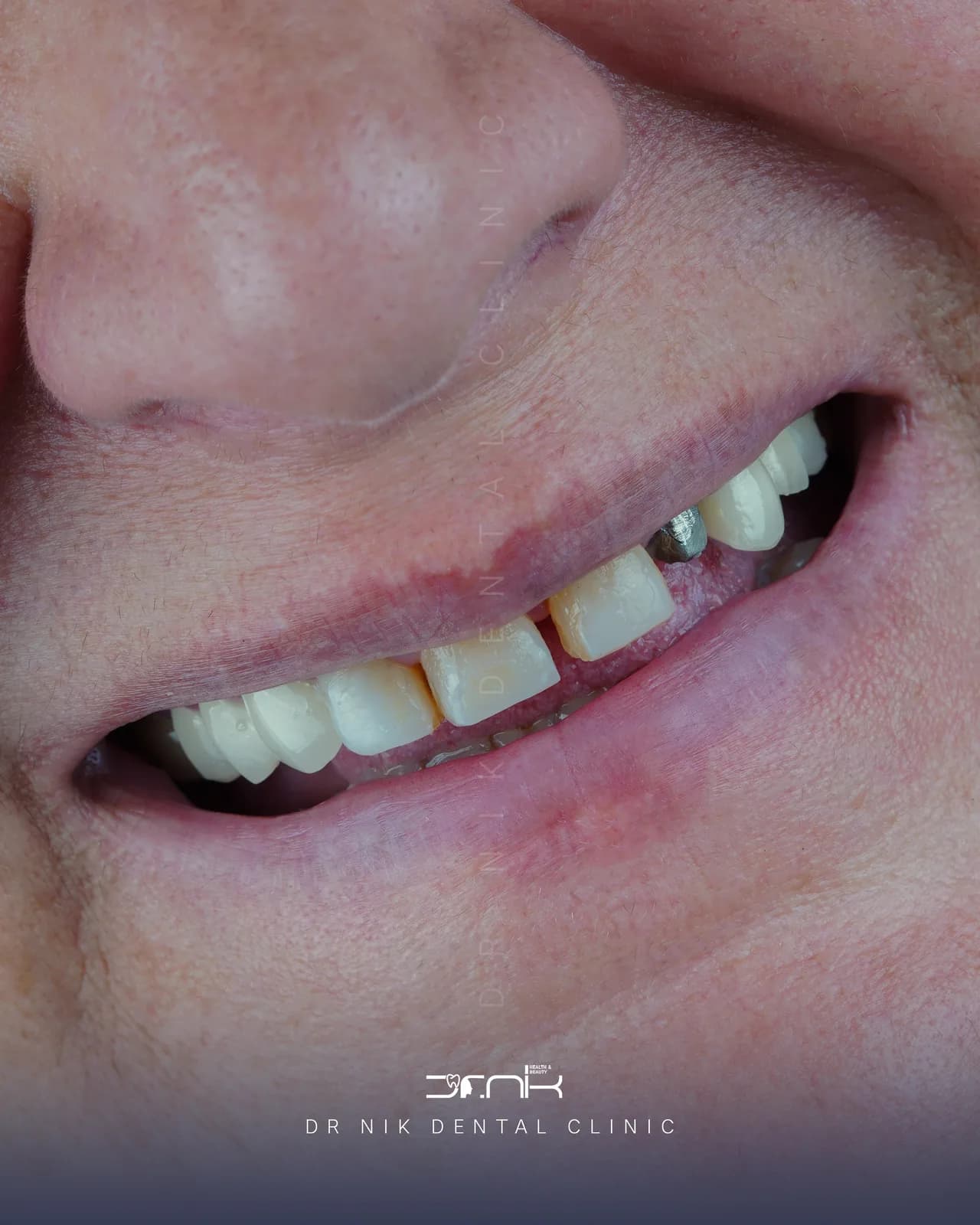 بیمار 8