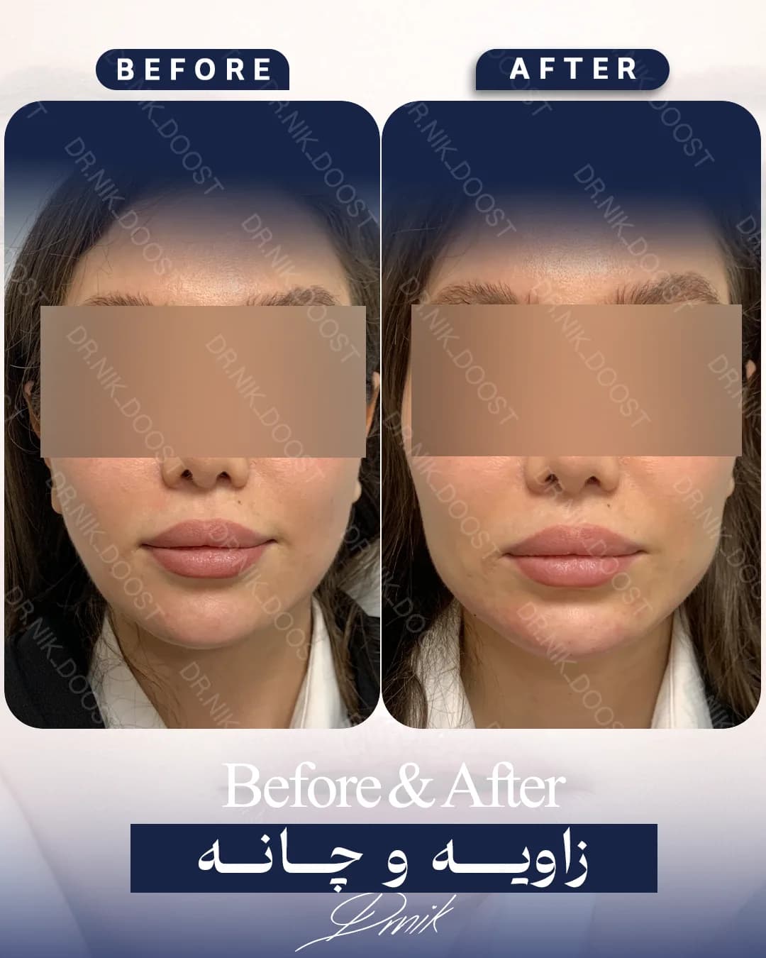 face-angle gallery