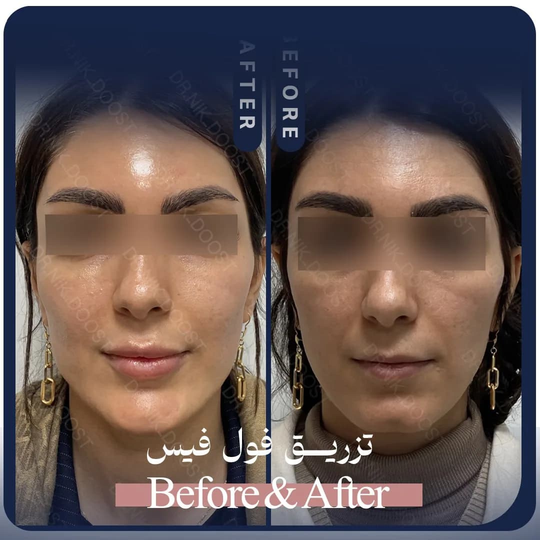 fullface gallery