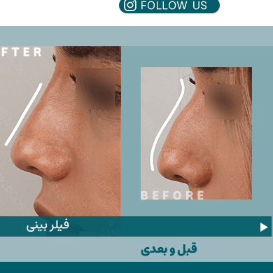 زیبایی صورت