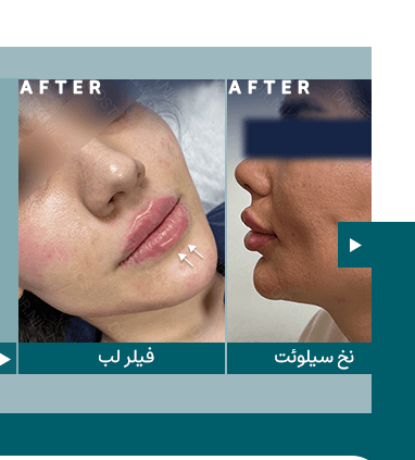 دندانپزشکی زیبایی